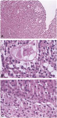 Optimizing Fertility in Primary Ovarian Insufficiency: Case Report and Literature Review